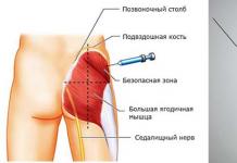 Buttock hurts after injection - how to treat?